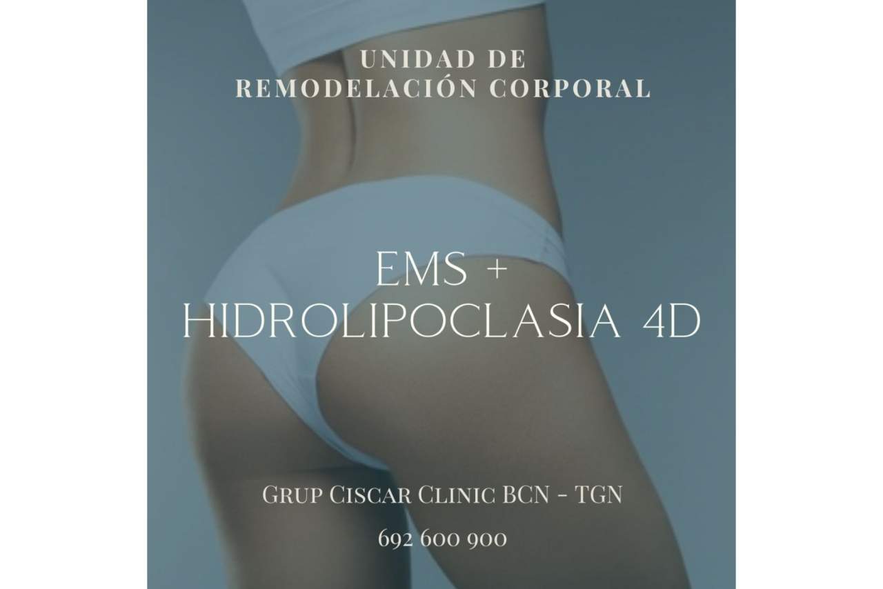 Hidrolipoclasia 4D antes y después: el tratamiento que permite eliminar grasa localizada en Barcelona por la Clínica Ciscar