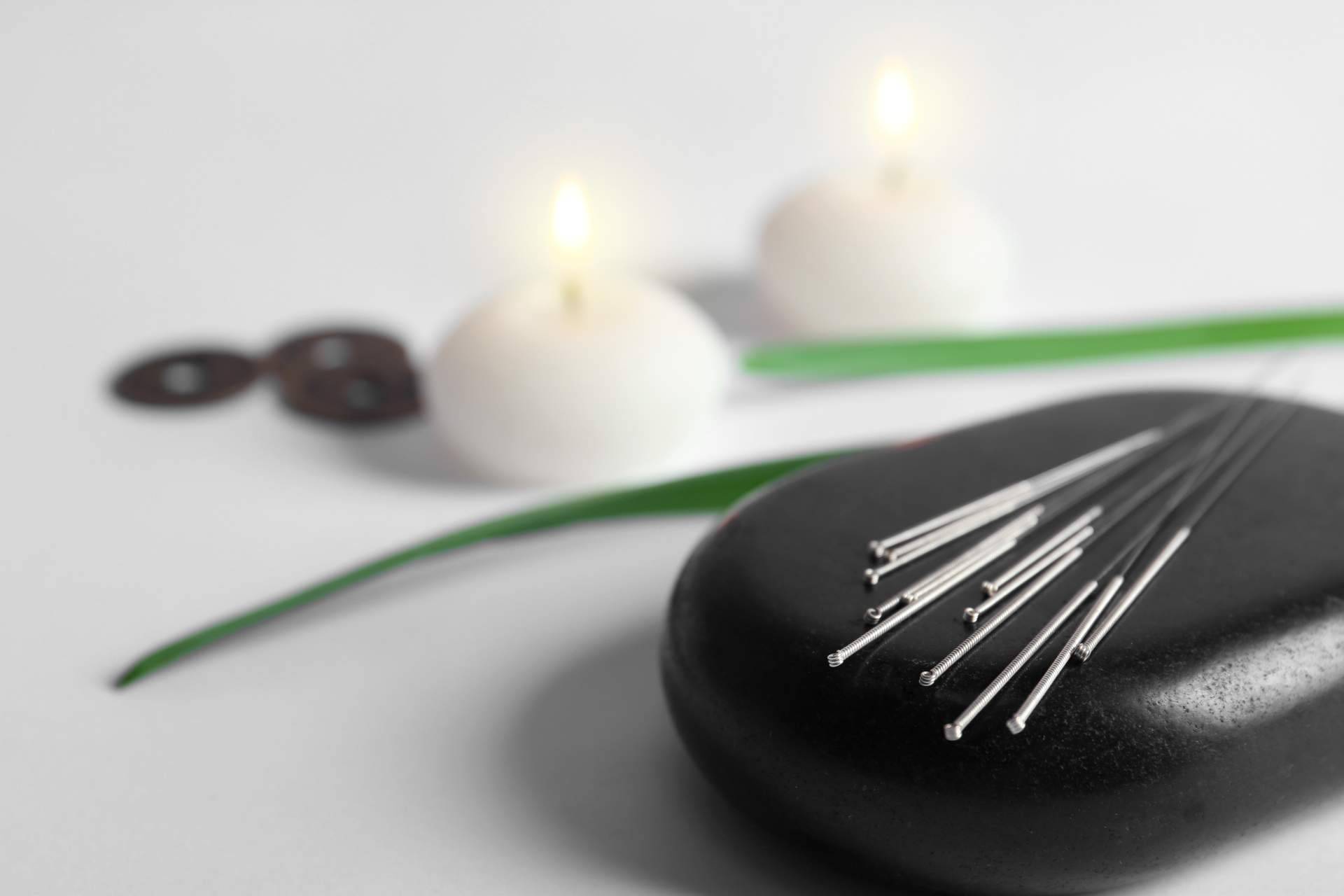 Shenti Wellness ofrece terapias de acupuntura